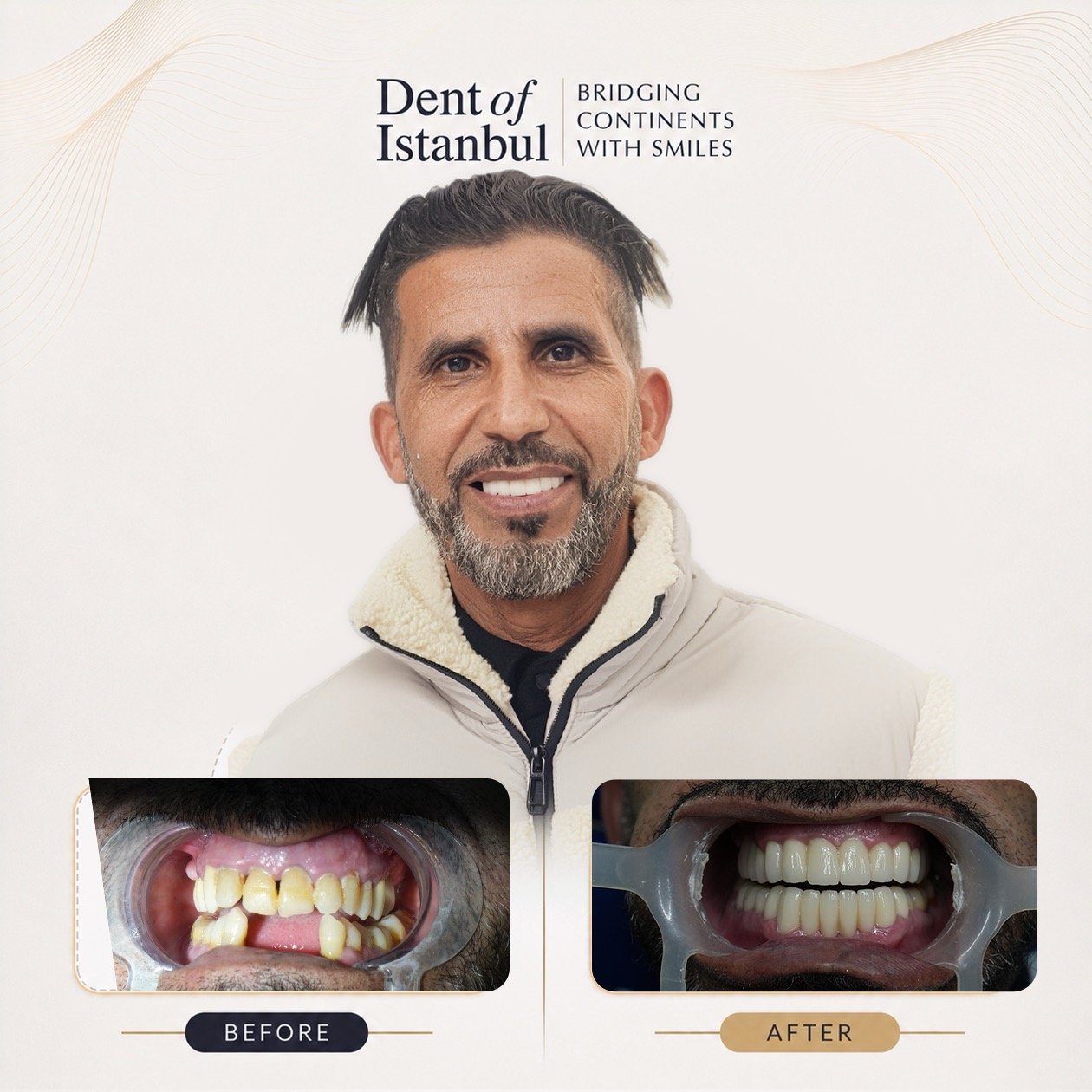 Abdullatif Before and After
